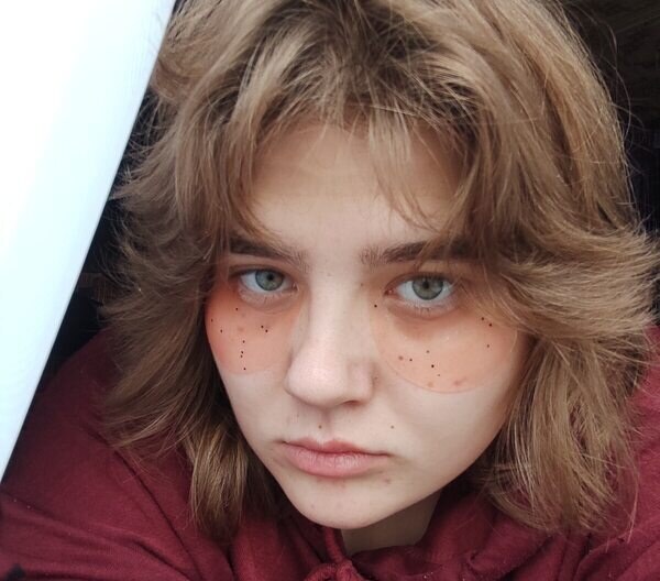 Альбина