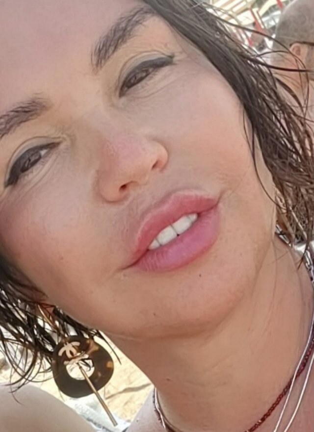 ALBINA